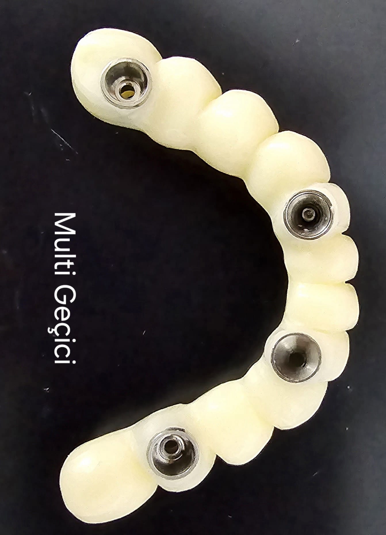 Multi Geçici İmplant